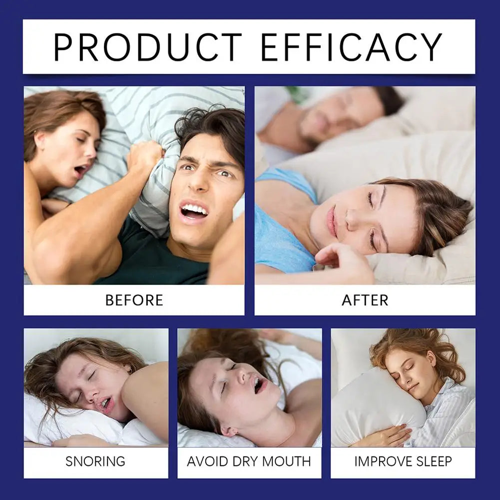 😴 Patch Anti-Ronflement – Correcteur de Respiration & Sommeil Réparateur